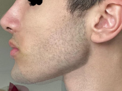 Side profile  by Reptiles