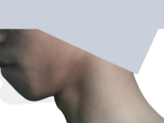 Very recessed face by Reptiles