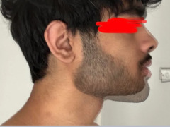 Recessed side profile by Reptiles