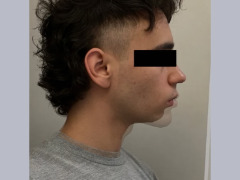 Recessed from before and after by Reptiles Recessed from before and after by Reptiles