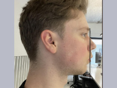 Facial land marks and improvement  by Reptiles