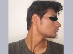Recessed profile by Reptiles