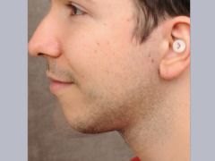 Side profile  by Reptiles