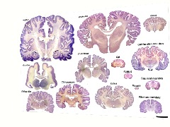 Brains by AngelSeva
