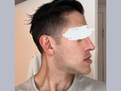 Recessed to forward face by Reptiles